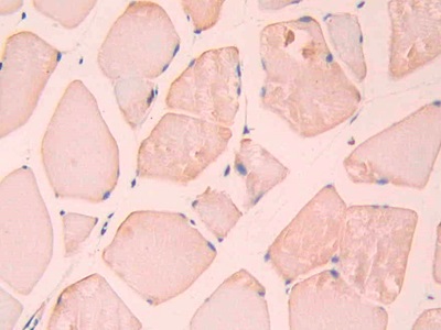 Carbonic Anhydrase XII (CA12) Rat Polyclonal Antibody