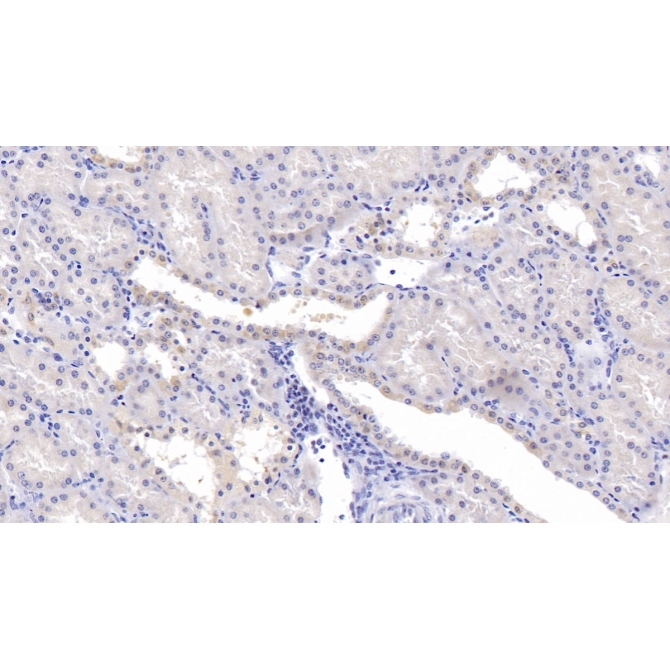 Carbonic Anhydrase XIII (CA13) Human Polyclonal Antibody