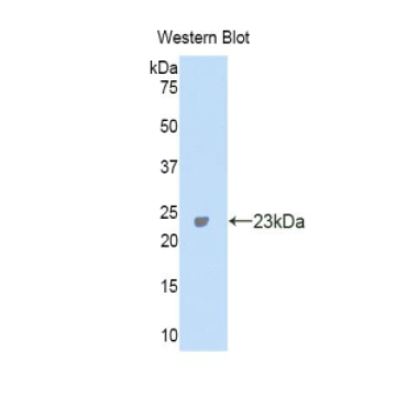 Carbonic Anhydrase VA (CA5A) Mouse Polyclonal Antibody