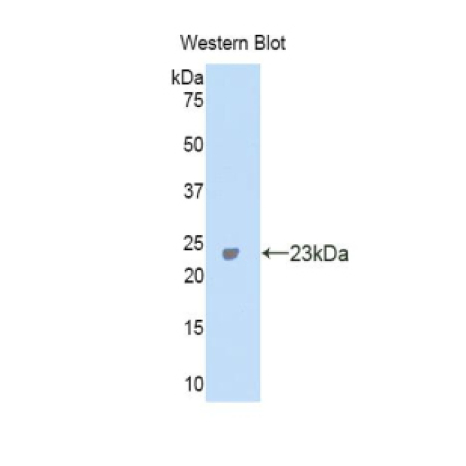 Carbonic Anhydrase VA (CA5A) Mouse Polyclonal Antibody