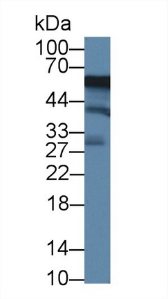 Acid Phosphatase 6, Lysophosphatidic (ACP6) Mouse Polyclonal Antibody