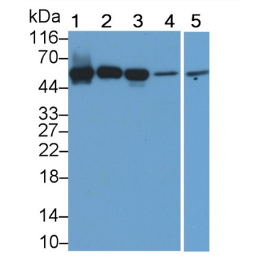 Acid Phosphatase 2, Lysosomal (ACP2) Human Polyclonal Antibody