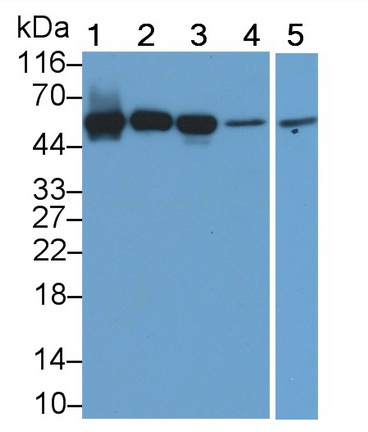 Acid Phosphatase 2, Lysosomal (ACP2) Human Polyclonal Antibody