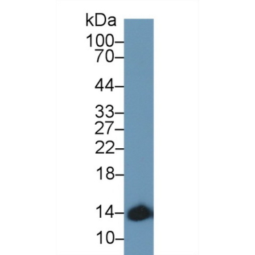 Hemoglobin Alpha 1 (HBa1) Human Polyclonal Antibody