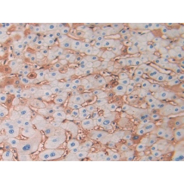 Hemoglobin Delta (HBd) Human Polyclonal Antibody