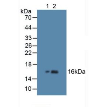 Hemoglobin Beta (HBb) Human Polyclonal Antibody