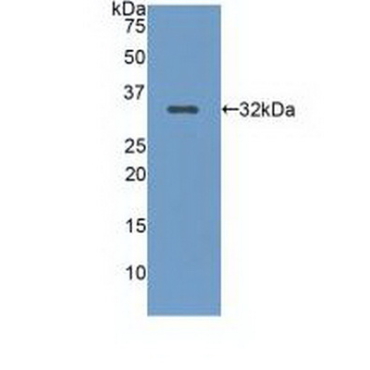 Low Density Lipoprotein Receptor Related Protein 5 (LRP5) Human Polyclonal Antibody