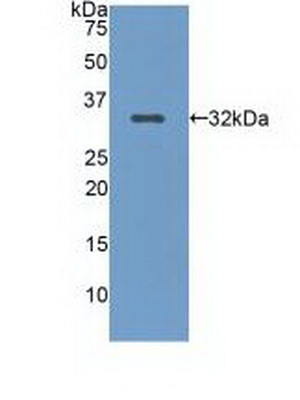 Low Density Lipoprotein Receptor Related Protein 5 (LRP5) Human Polyclonal Antibody