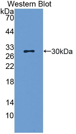 Low Density Lipoprotein Receptor Related Protein 5 (LRP5) Rat Polyclonal Antibody