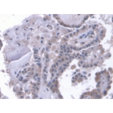 Low Density Lipoprotein Receptor Related Protein 1B (LRP1B) Human Polyclonal Antibody