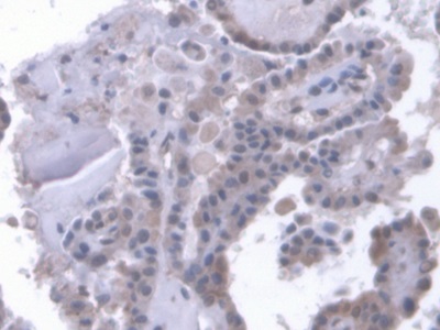 Low Density Lipoprotein Receptor Related Protein 1B (LRP1B) Human Polyclonal Antibody