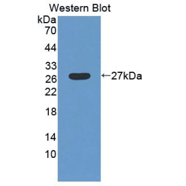 Low Density Lipoprotein Receptor Related Protein 1B (LRP1B) Mouse Polyclonal Antibody