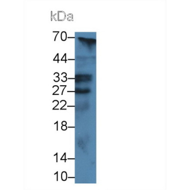 Low Density Lipoprotein Receptor Adaptor Protein 1 (LDLRAP1) Mouse Polyclonal Antibody