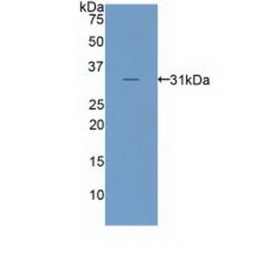 Low Density Lipoprotein Receptor Related Protein 6 (LRP6) Human Polyclonal Antibody