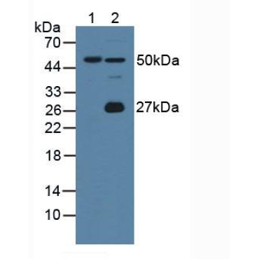 Gastric Intrinsic Factor (GIF) Mouse Polyclonal Antibody