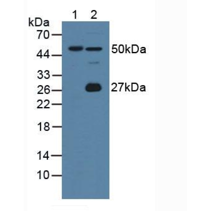 Gastric Intrinsic Factor (GIF) Mouse Polyclonal Antibody