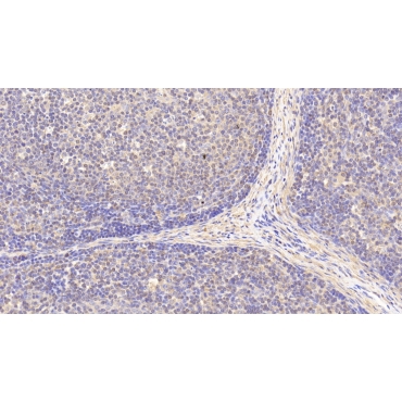 Antigen Peptide Transporter 2 (TAP2) Human Polyclonal Antibody