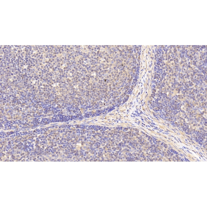 Antigen Peptide Transporter 2 (TAP2) Human Polyclonal Antibody