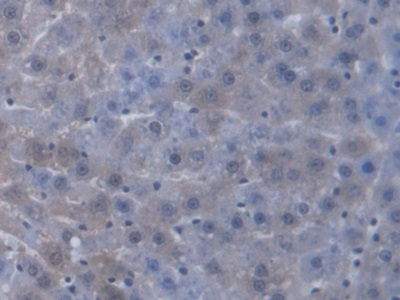 Antigen Peptide Transporter 2 (TAP2) Rat Polyclonal Antibody