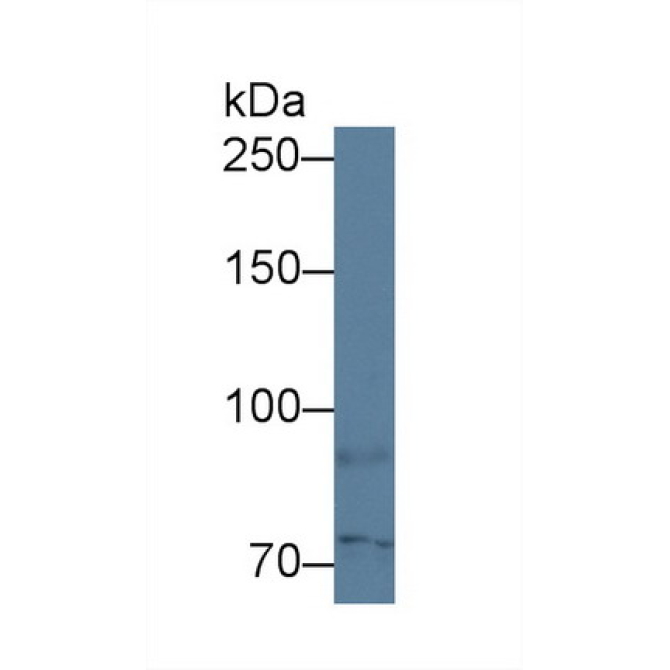 Antigen Peptide Transporter 1 (TAP1) Human Polyclonal Antibody