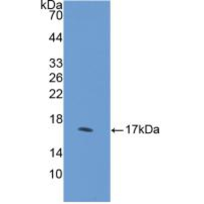 Hedgehog Homolog, Desert (DHH) Human Polyclonal Antibody