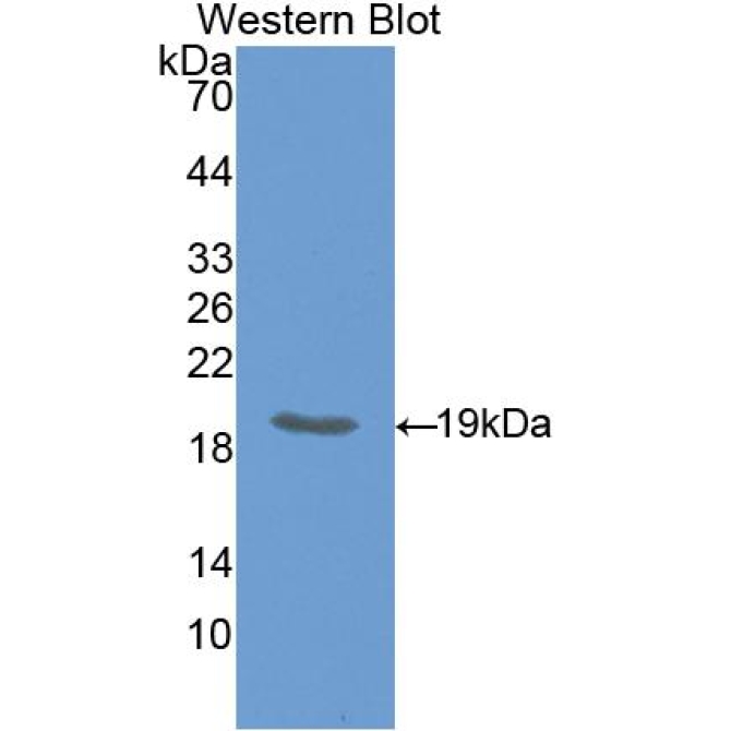 Hedgehog Homolog, Indian (IHH) Human Polyclonal Antibody