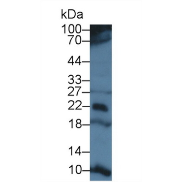 T-Cell Surface Glycoprotein CD3 Epsilon (CD3e) Human Polyclonal Antibody