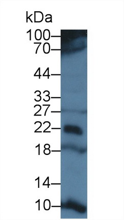 T-Cell Surface Glycoprotein CD3 Epsilon (CD3e) Human Polyclonal Antibody