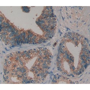 Collagen Type VI (COL6) Human Polyclonal Antibody