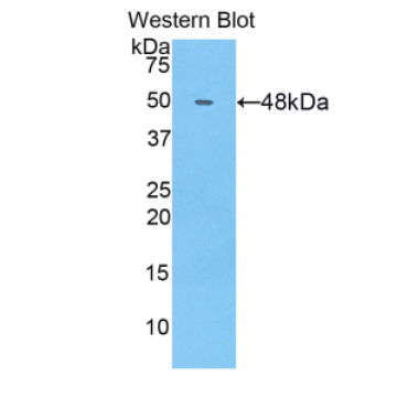 Collagen Type XIV (COL14) Human Polyclonal Antibody