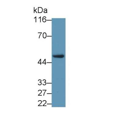 Liver X Receptor Beta (LXRb) Human Polyclonal Antibody