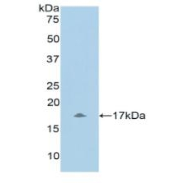 Urocortin 3 (UCN3) Human Polyclonal Antibody