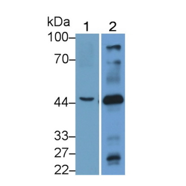 Cholinergic Receptor, Nicotinic, Beta 3 (CHRNb3) Human Polyclonal Antibody