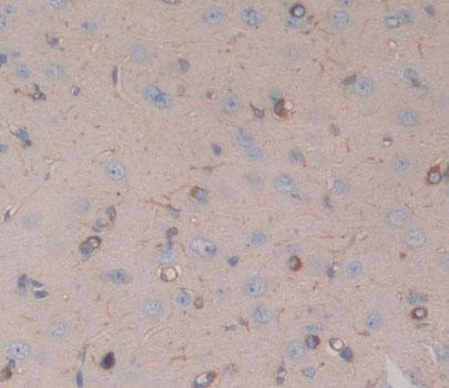 Cholinergic Receptor, Nicotinic, Alpha 10 (CHRNa10) Rat Polyclonal Antibody