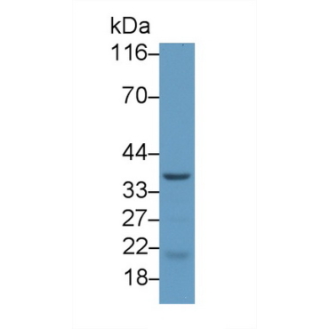 Cholinergic Receptor, Nicotinic, Epsilon (CHRNe) Mouse Polyclonal Antibody
