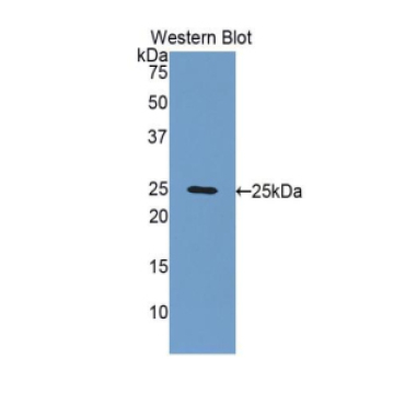 Fibulin 2 (FBLN2) Human Polyclonal Antibody