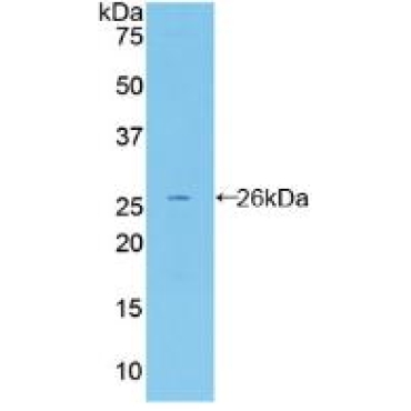 Fibulin 2 (FBLN2) Mouse Polyclonal Antibody