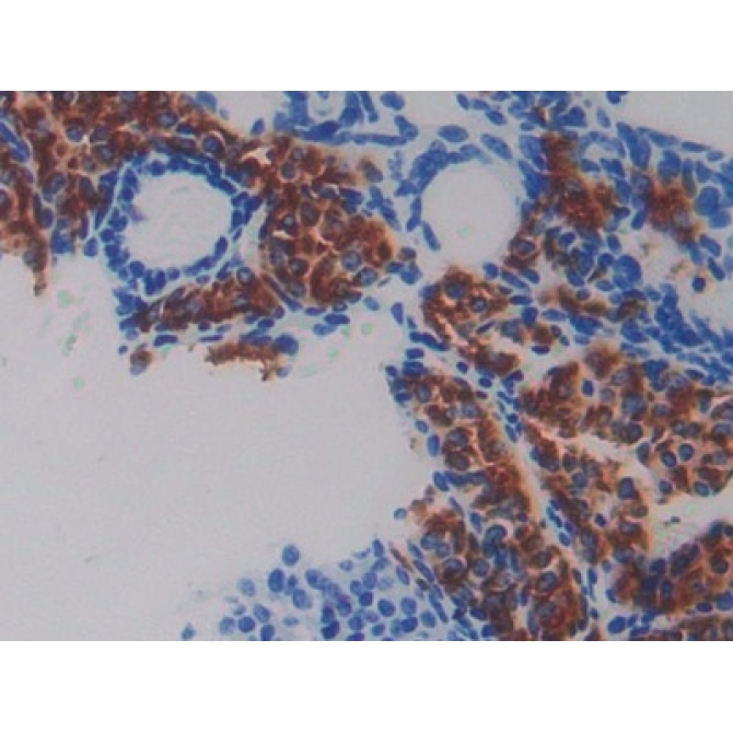 Fibulin 5 (FBLN5) Mouse Polyclonal Antibody