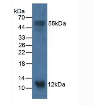 S100 Calcium Binding Protein A14 (S100A14) Human Polyclonal Antibody