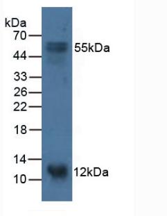 S100 Calcium Binding Protein A14 (S100A14) Human Polyclonal Antibody