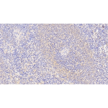 S100 Calcium Binding Protein Z (S100Z) Human Polyclonal Antibody