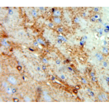 Chemokine C-C-Motif Ligand 4 Like Protein 1 (CCL4L1) Human Polyclonal Antibody