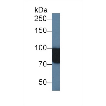 N-Acetyl Alpha-D-Glucosaminidase (NAGLU) Human Polyclonal Antibody