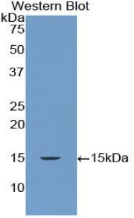 Ribonuclease III, Nuclear (RNASEN) Human Polyclonal Antibody