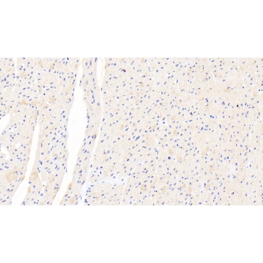5'-3'Exoribonuclease 1 (XRN1) Human Polyclonal Antibody