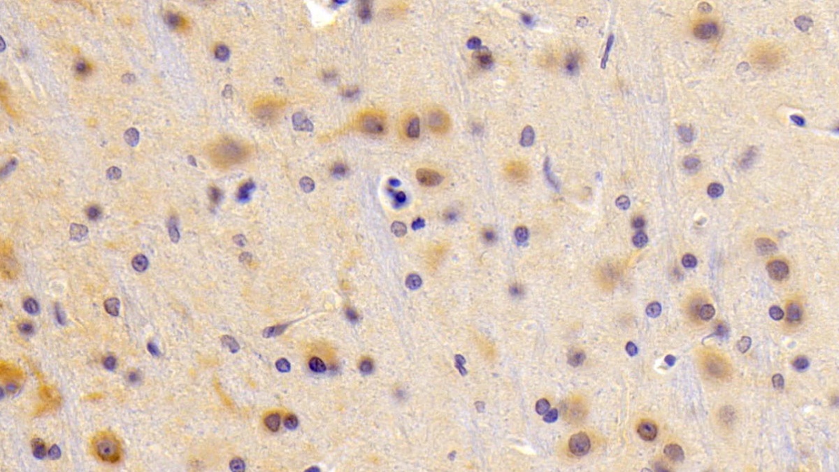 5'-3'Exoribonuclease 1 (XRN1) Rat Polyclonal Antibody