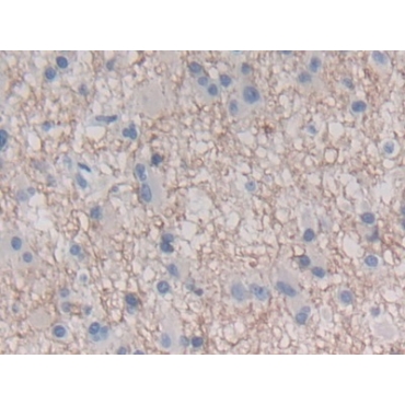 Interferon Epsilon (IFNe) Human Polyclonal Antibody