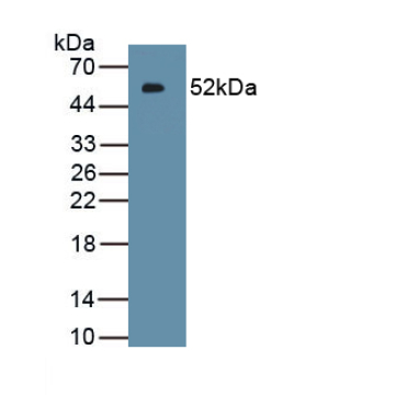 Interferon Kappa (IFNk) Human Polyclonal Antibody