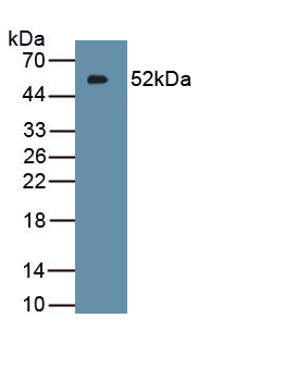 Interferon Kappa (IFNk) Human Polyclonal Antibody