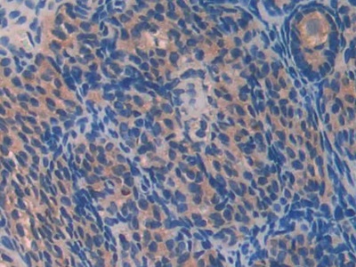Paraoxonase 2 (PON2) Mouse Polyclonal Antibody